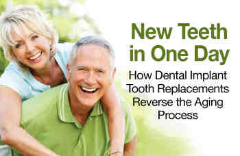 How do they do full dental implants in one day?