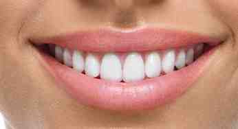 How do you finance cosmetic dentistry?