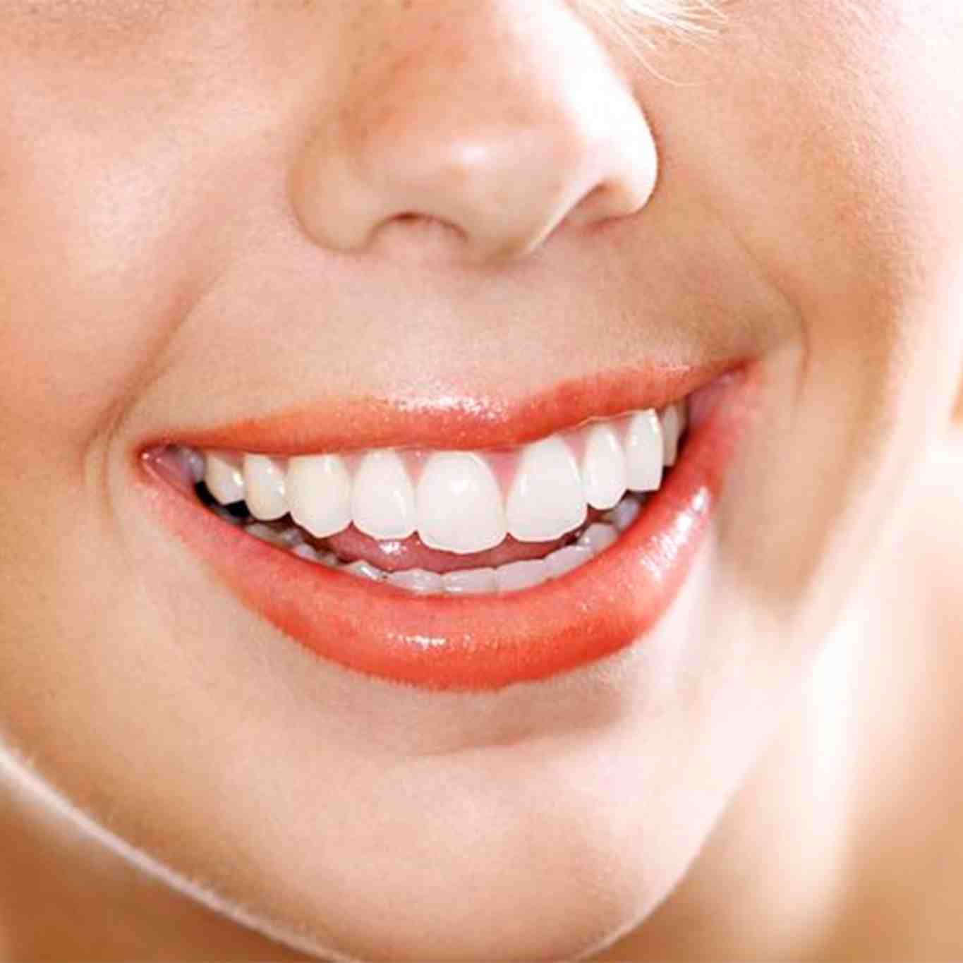 How do you get rid of fluorosis on teeth?