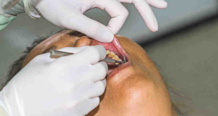 How long can you wait to get a dental implant after extraction
