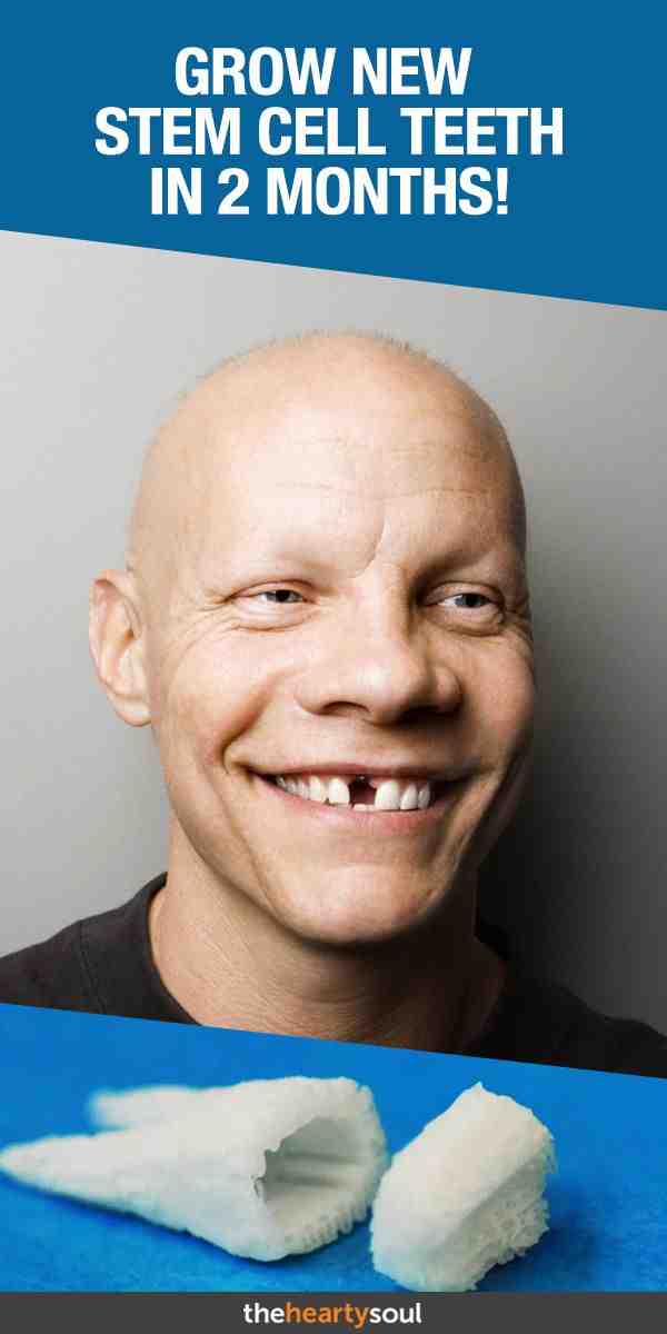 How long does it take to get stem cell teeth?