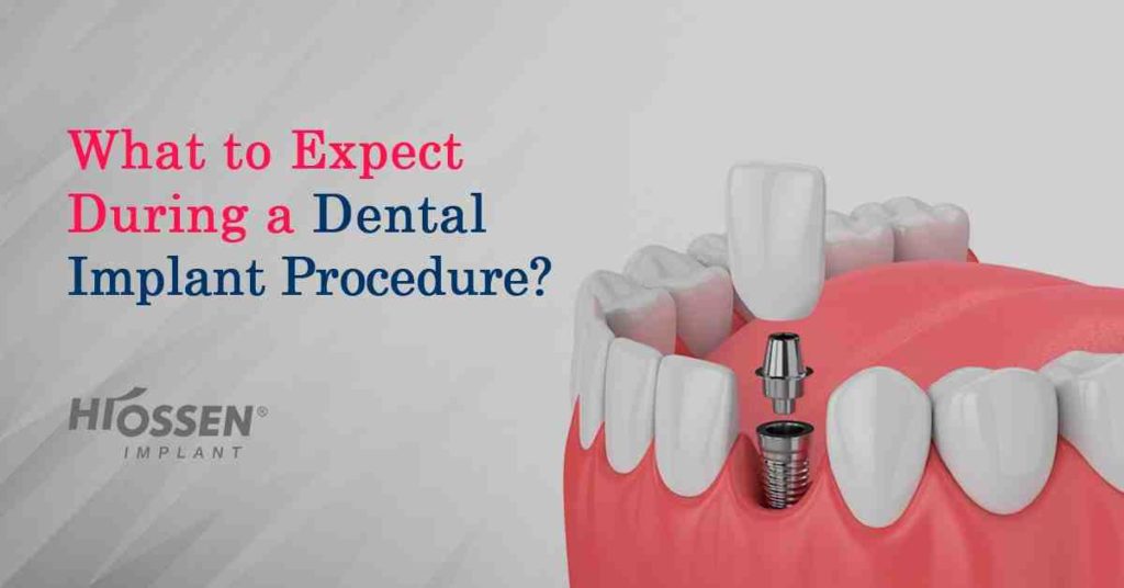 How long does swelling last after dental implant Dental News Network