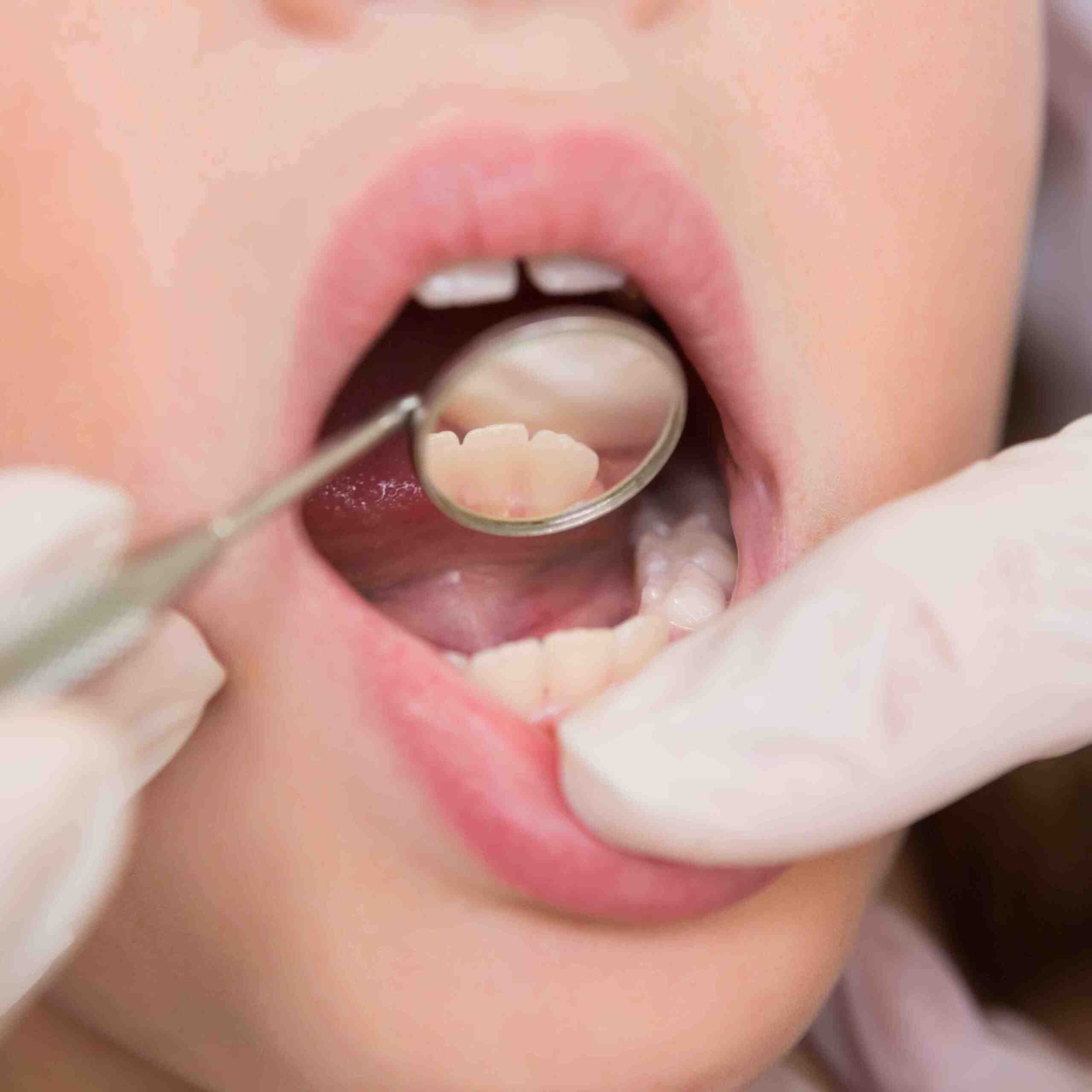 How long does the pain last after a dental implant?