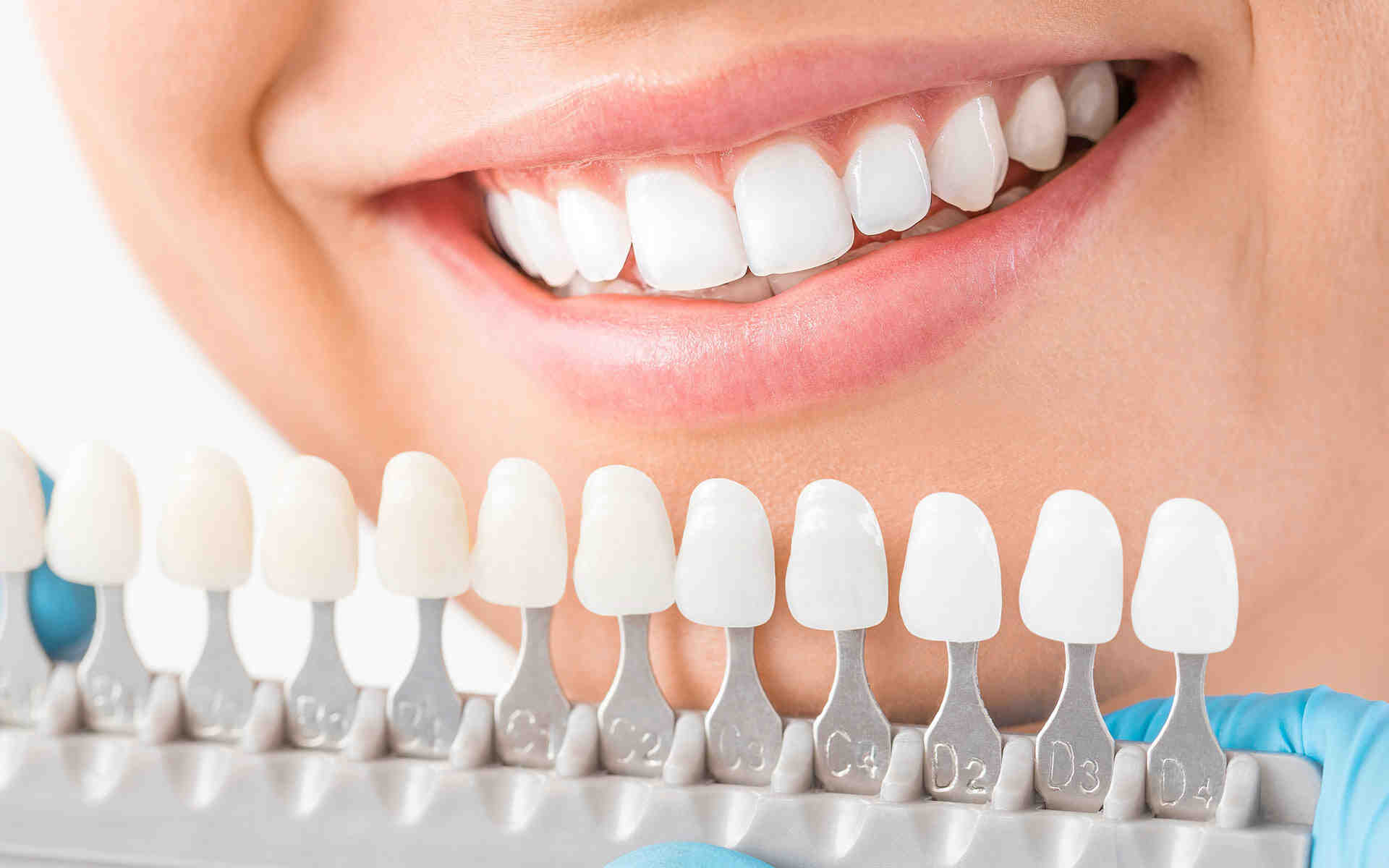 How Long Should Dental Implants Last Dental News Network