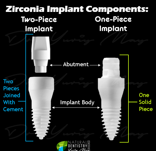 How many teeth can be attached to an implant?