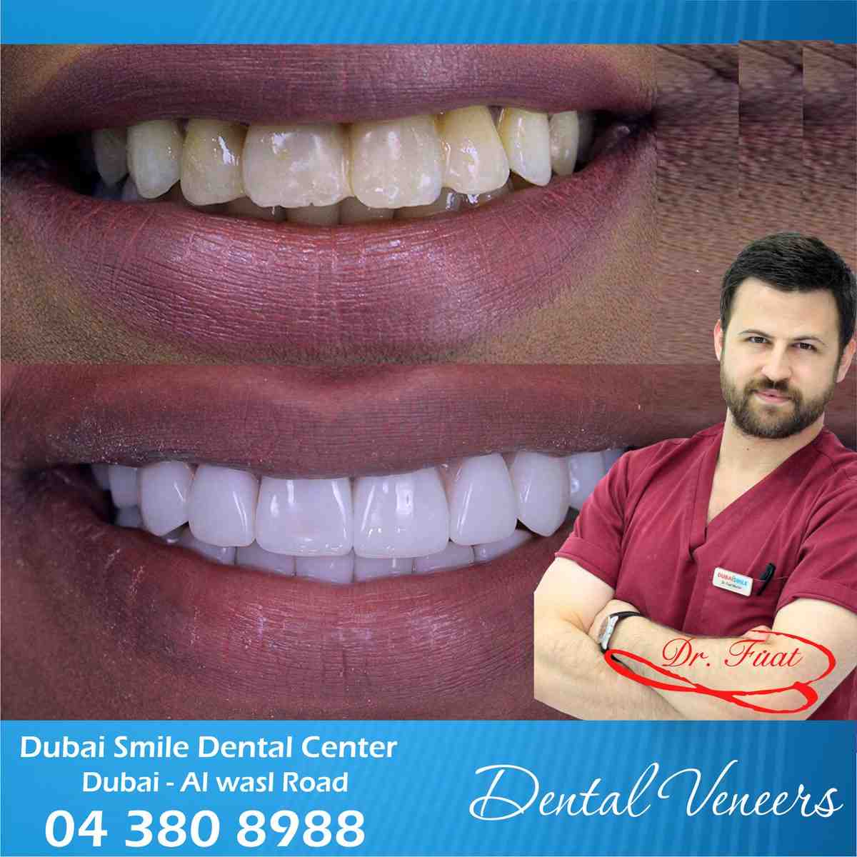Cosmetic dentistry dubai Dental News Network