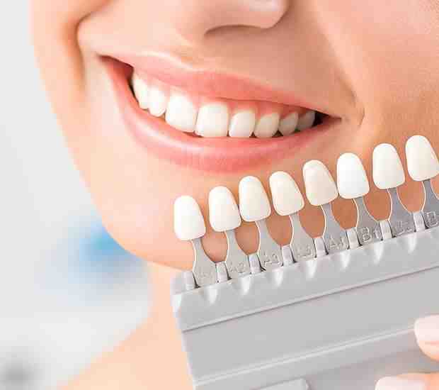 How much do cosmetic dental veneers cost?
