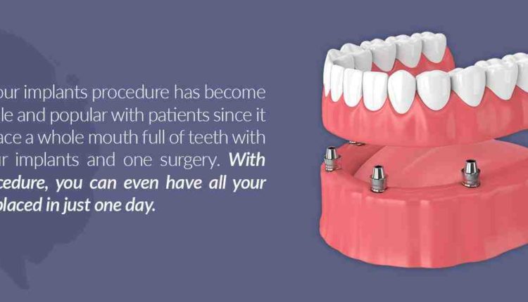 How much do dental implants cost in tucson arizona