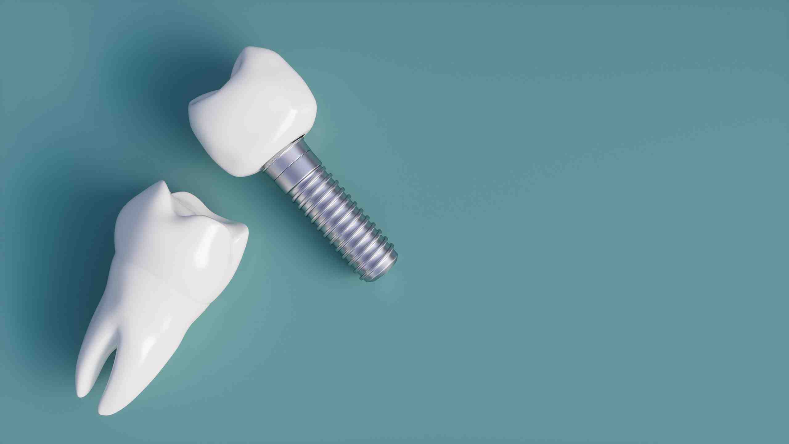 How much does a dental implant cost for one tooth?