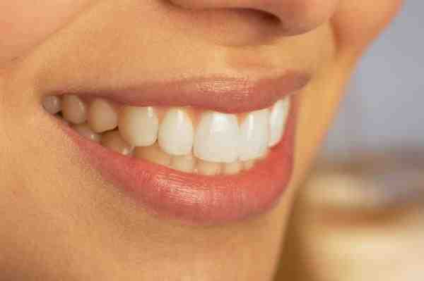 How much does cosmetic dental work cost?