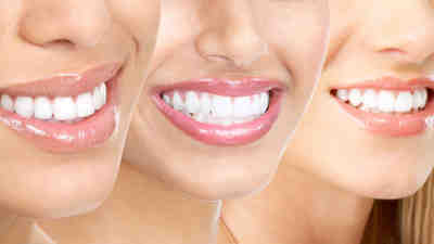 How much does cosmetic dental work cost?