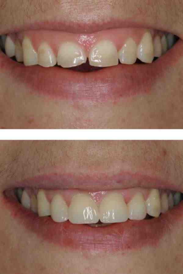 Cosmetic dentistry dr. meyer Dental News Network