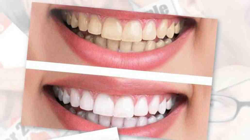 Cosmetic dentistry dublin Dental News Network