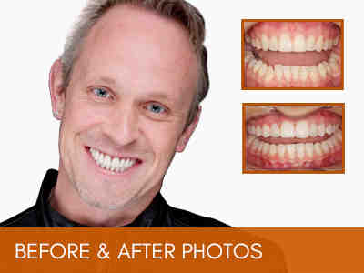 How much does it cost to extract teeth?