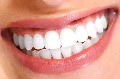 How much does it cost to get fake permanent teeth?