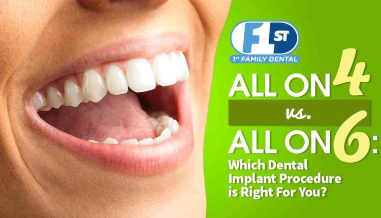 How much for 3 dental implants