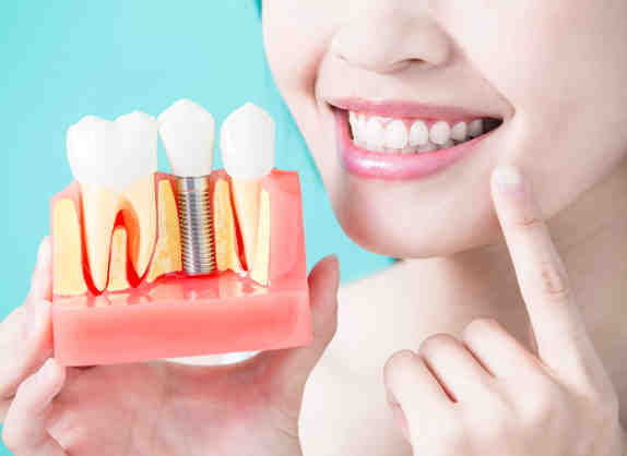 How often do dental implants need to be replaced?