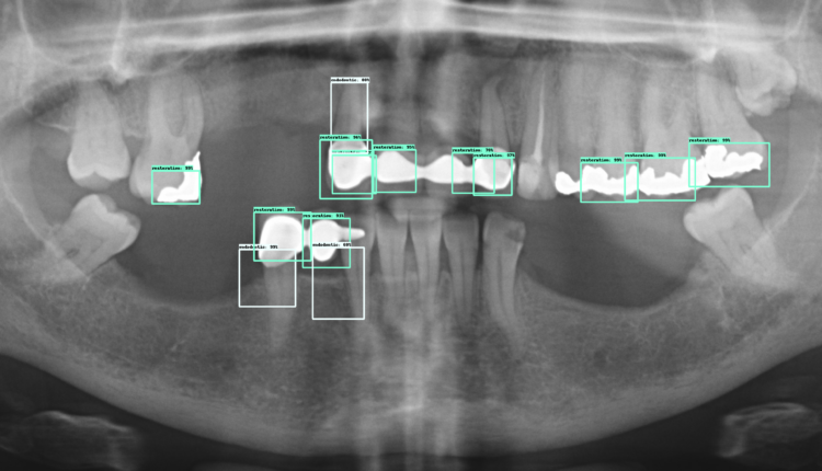 How to identify dental implants by x ray