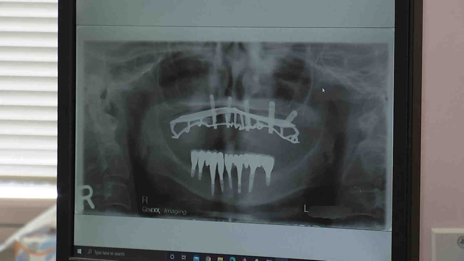 Cosmetic dentistry grants, los angeles Dental News Network