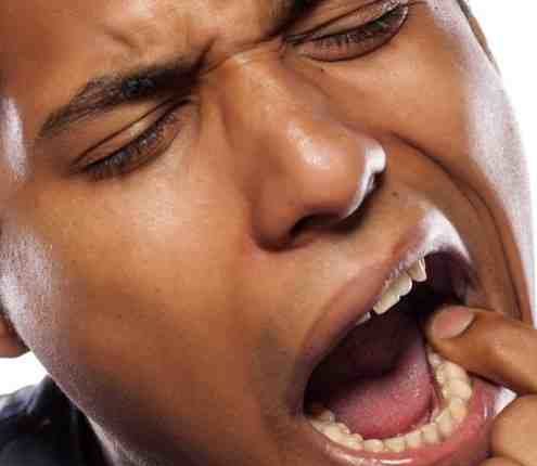 Is it necessary for me to get a dental implant after pulling my lower back molar