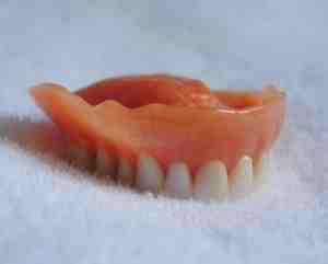 Is there a cheaper alternative to dental implants?