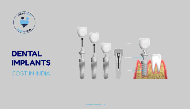 What conditions make implants unlikely for dental replacement