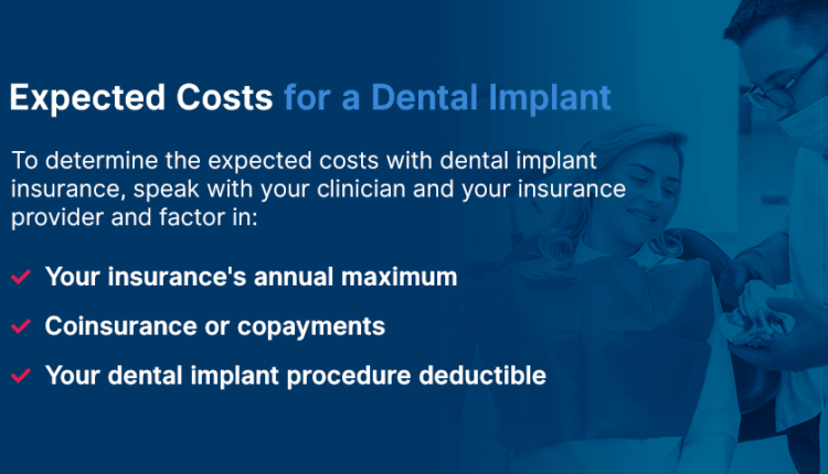 What dental insurance covers implants?