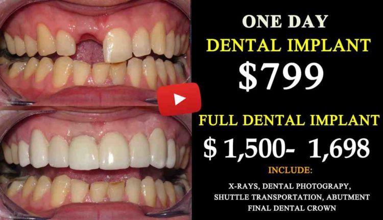 What is average cost of a dental implant