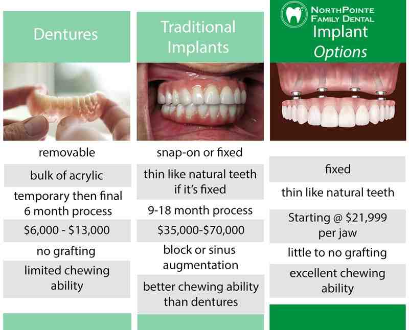 How Much Do Full Mouth Dental Implants Cost Dental News Network   What Is The Average Price For Full Mouth Dental Implants 2 