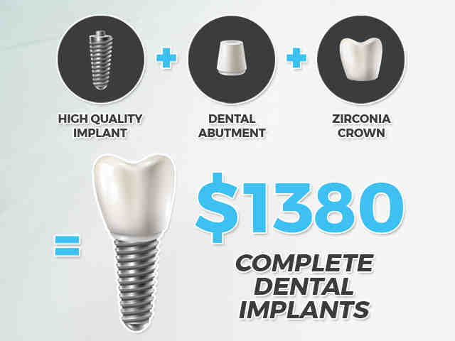 What is the average price for full mouth dental implants?