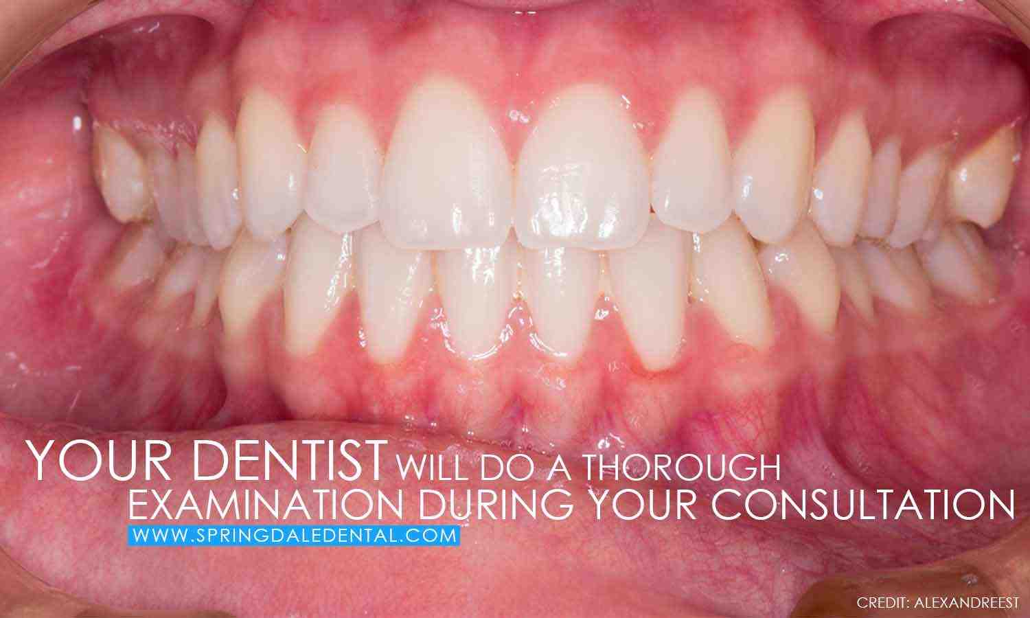 What is the lifespan of dental implants?