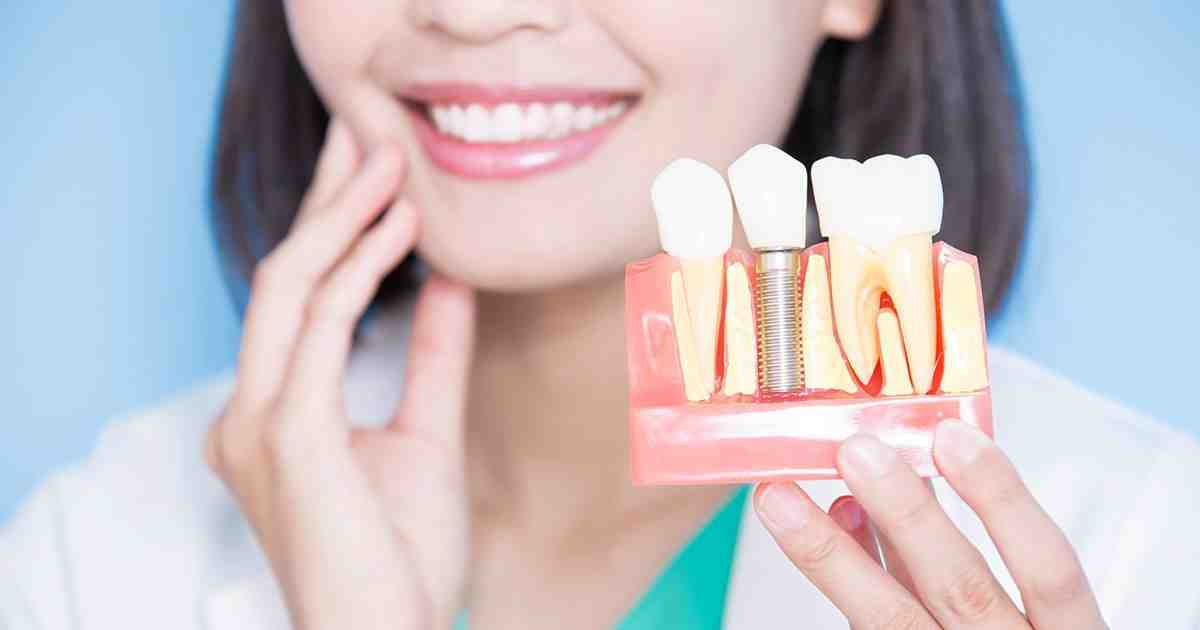 What should I avoid after dental implants?
