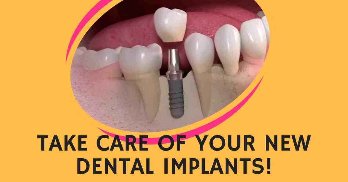 What to avoid after dental implants?