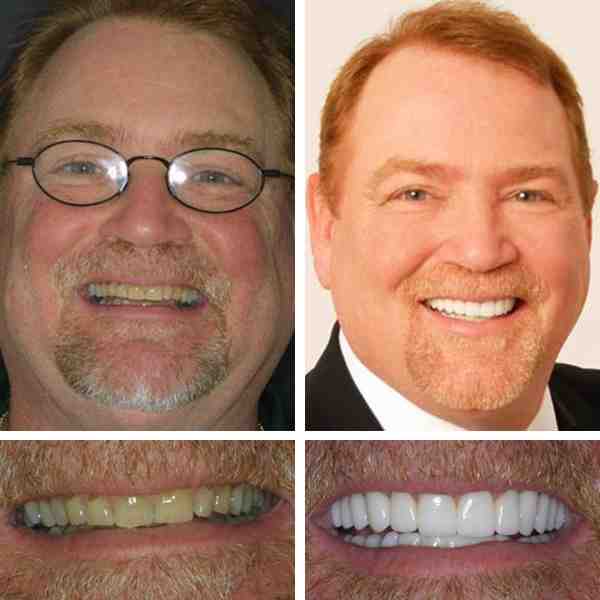Cosmetic dentistry for the poor Dental News Network