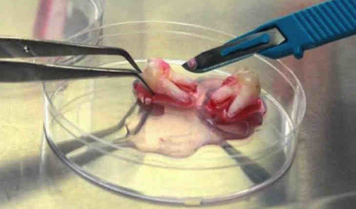 Where can i go to get the stem cell dental implants