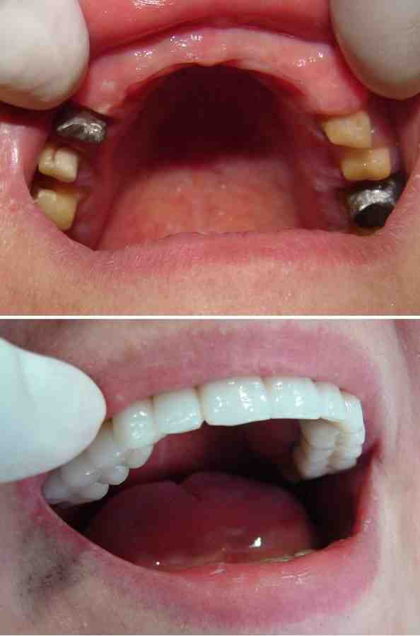 Where is the best country for dental work?