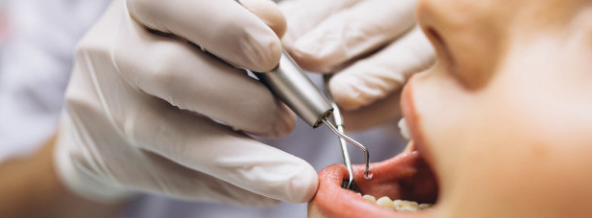 Where is the best place in Europe for dental implants?