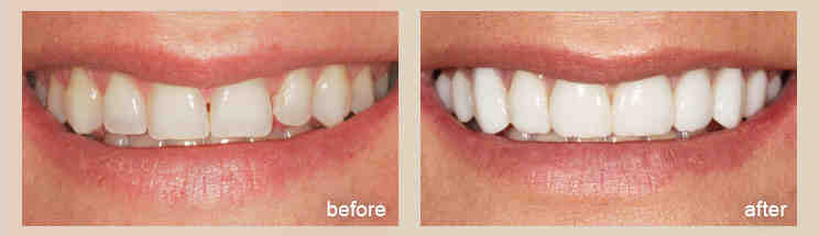 Which European country has the cheapest dental care?