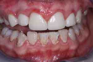 Which country is cheapest for dentistry?