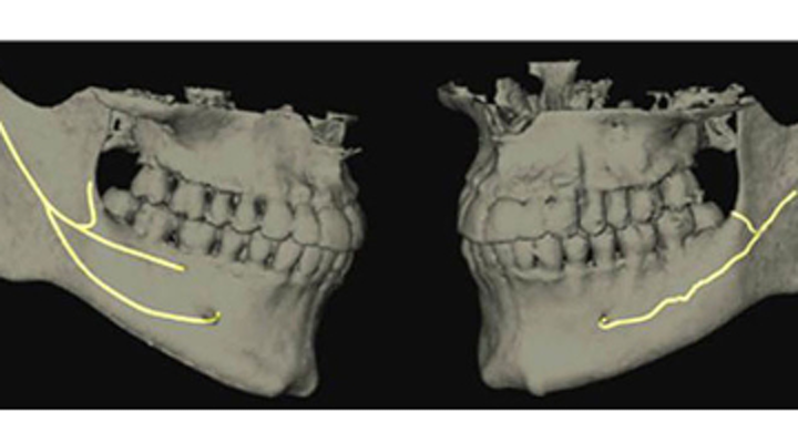 Who is best qualified to do dental implants?