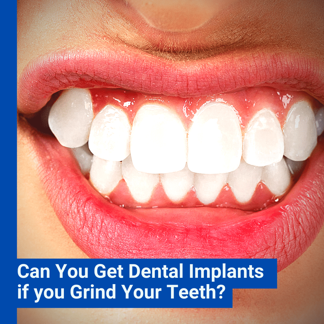 Who should perform dental implant surgery?