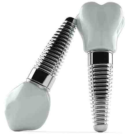 Why does dental insurance not pay for implants?