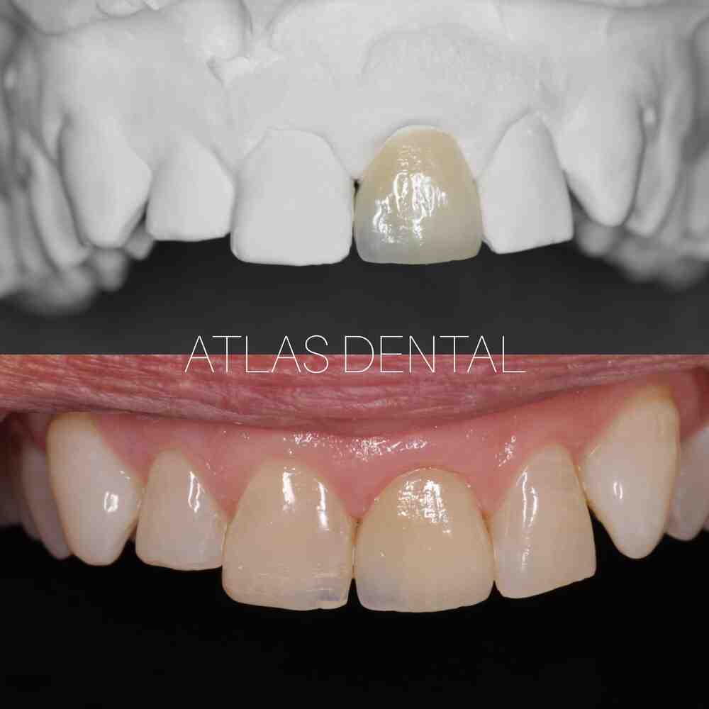 Cosmetic dentistry is too expensive Dental News Network