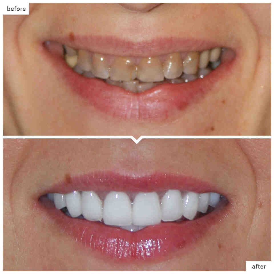 Can a general dentist do cosmetic dentistry?