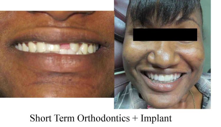 Cosmetic dentistry in jamaica