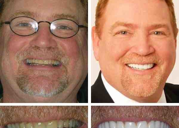 Cosmetic dentistry in sarasota fl