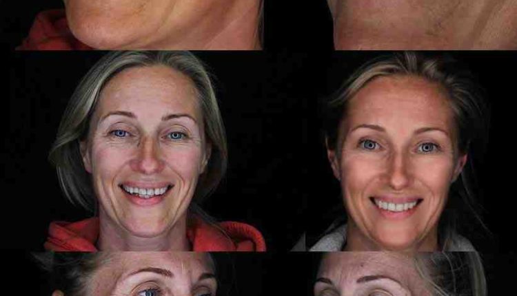 Cosmetic dentistry in tijuana