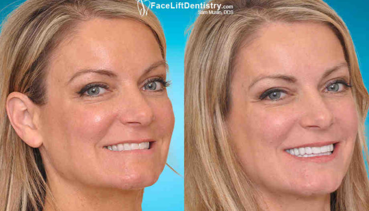 Cosmetic dentistry is too expensive