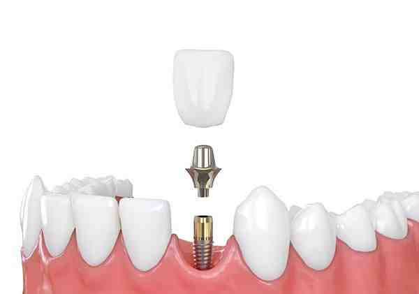 Does Colombia have good dentist?