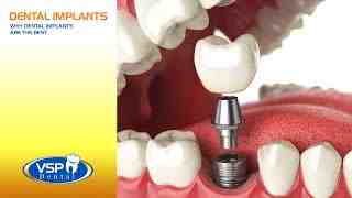 Does the VA do dental work?